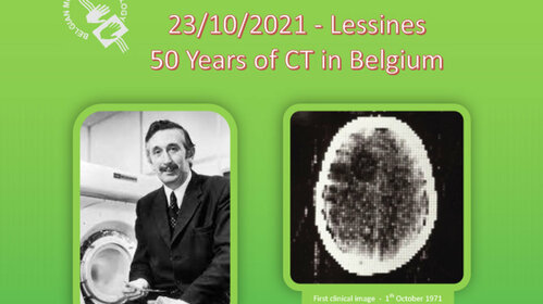 50 Years of CT in Belgium