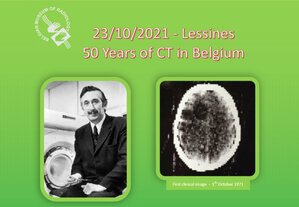 50 Years of CT in Belgium